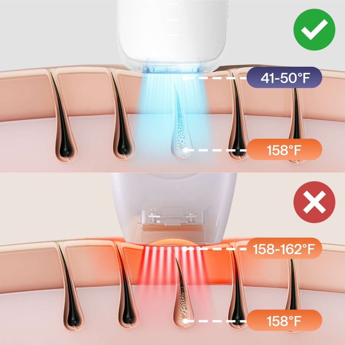 Ulike Air 3 IPL Hair Removal Device White